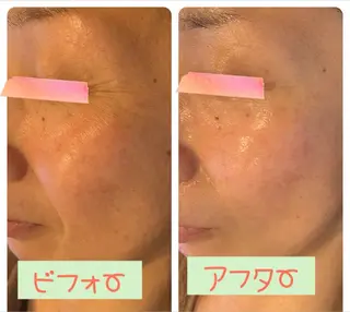 キッズ Pole Poleのエステ・リラクイメージ