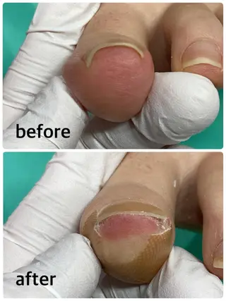 東京巻き爪 アカデミーのエステ・リラクイメージ