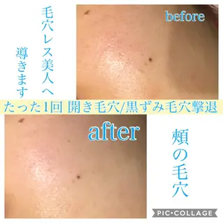 ショート カラー パーマ ヘアアレンジ キッズ ネイル マツエク・マツパ EnsorClair 代表 野口真央のエステ・リラクイメージ