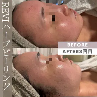 lumi riseのエステ・リラクイメージ