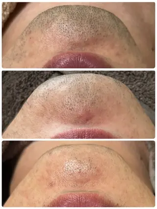 メンズ abeshial所属・abeshial 〜美・健康・笑顔〜の眉毛・アイブロウイメージ