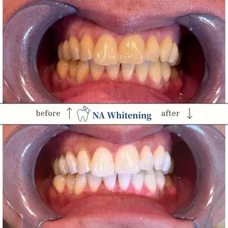 NAホワイトニング溝の口店所属・NAホワイトニング 溝の口店のエステ・リラクイメージ