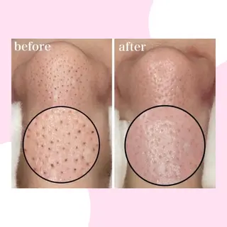 韓国肌管理Mote 新宿店のエステ・リラクイメージ