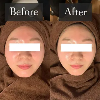 脱毛専門サロン BELFINE恵比寿のエステ・リラクイメージ