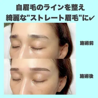 アイブロウ Lea堺東　毛穴洗浄 ×顔ワックス脱毛のその他イメージ