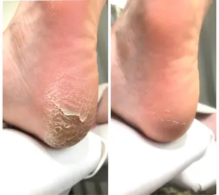 ⭐️遠藤 夏純⭐️のエステ・リラクイメージ