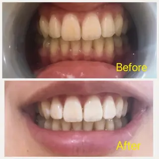 Ｍ渋谷 ホワイトニングのエステ・リラクイメージ