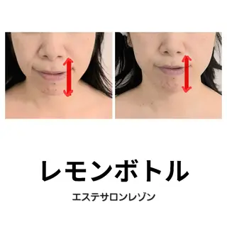 ニキビ・ニキビ跡専門 レゾン京橋店　のエステ・リラクイメージ