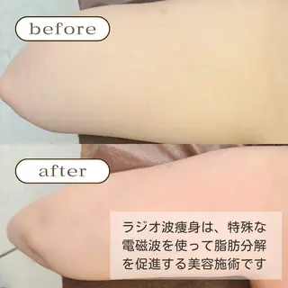 美肌・痩身・脱毛当日 予約◎ZENITHのエステ・リラクイメージ