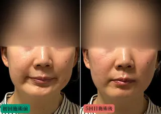 美容とカラダの鍼灸 サロン やなけんのエステ・リラクイメージ