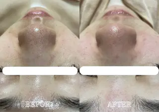 Lys Blanc OTOKAのエステ・リラクイメージ