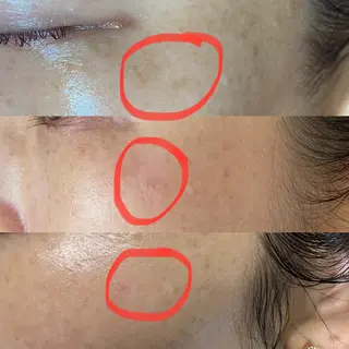 Meetite 小林のエステ・リラクイメージ