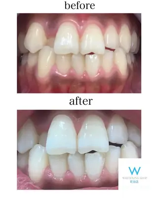 メンズ キッズ ホワイトニング ショップ町田店のその他イメージ