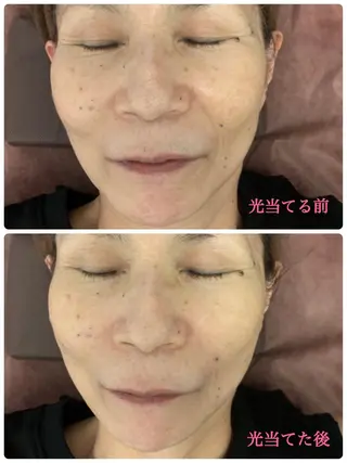 Mens Salon SOLEのエステ・リラクイメージ