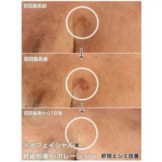 LAESSE 恵比寿所属・毛穴と美白の専門店 LAESSE 恵比寿のエステ・リラクイメージ