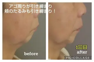 beauty  salon 向日葵のエステ・リラクイメージ