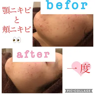 セミロング カラー パーマ ヘアアレンジ メンズ キッズ ネイル マツエク・マツパ 金の糸脱毛 産毛ケア専門のエステ・リラクイメージ