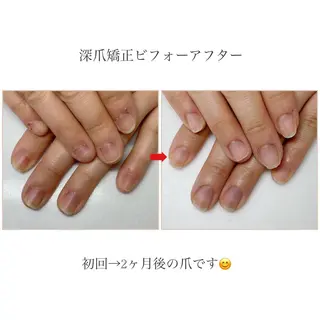 ネイル ネイルサロン アリュームのネイルデザイン