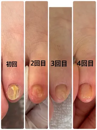 ネイル Alo.nail アロ•ネイルのネイルデザイン