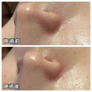 🌴Beauty Salon LANAのエステ・リラクイメージ