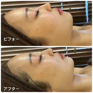 LILY Eのエステ・リラクイメージ