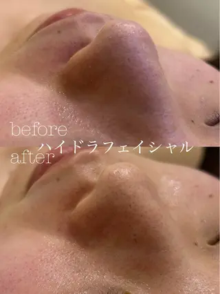 メンズ フェイシャルサロン CHIARA 荒田のエステ・リラクイメージ