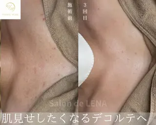 ハーブピーリング専門 サロンドレナ　白藤のエステ・リラクイメージ