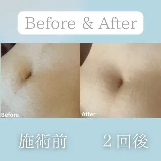 美肌脱毛&毛穴専門 Nico🐰ྀི♡のエステ・リラクイメージ