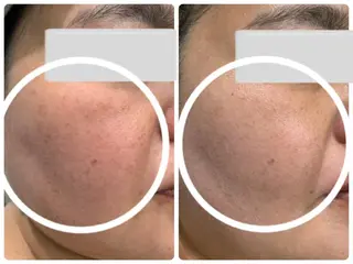 PIP🌹 さえのマツエク・マツパデザイン