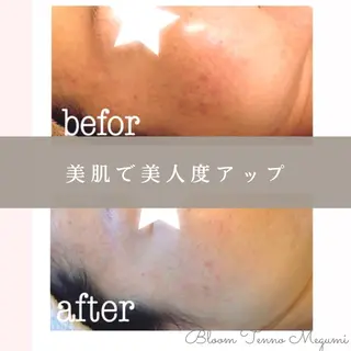 BLOOM〜 天恵（てんのめぐみ）のエステ・リラクイメージ