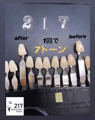 メンズ キッズ 217 ホワイトニングルームのエステ・リラクイメージ