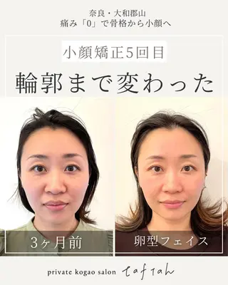 小顔   目元専門 taftahタフタのマツエク・マツパデザイン