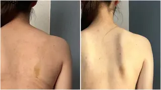 湘南エステサロン moaのエステ・リラクイメージ