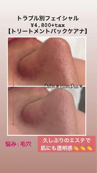 福井 ひとみのエステ・リラクイメージ