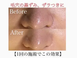 🌸🧡六本木 脱毛しずか🧡🫧の眉毛・アイブロウイメージ