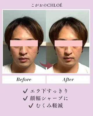 小顔サロン こがおのCHLOÉのエステ・リラクイメージ
