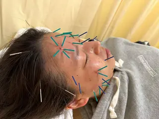 鍼灸サロン BBB3のその他イメージ