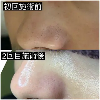 Luralïy hair kitakyushu所属・Luralïy ルーラリーのエステ・リラクイメージ