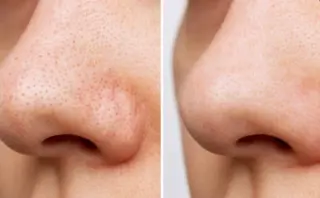 DESIGN FAM エステのエステ・リラクイメージ