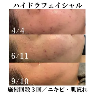 トータルビューティー サロンSalaのマツエク・マツパデザイン