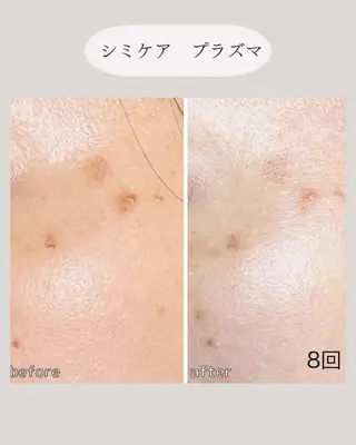 小顔＆肌質改善 NICORIのエステ・リラクイメージ