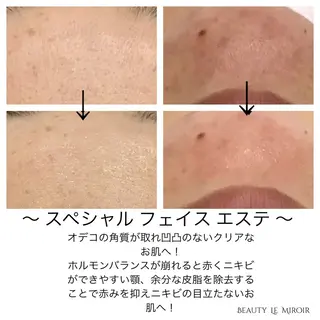 ビューティー ミロワールのエステ・リラクイメージ