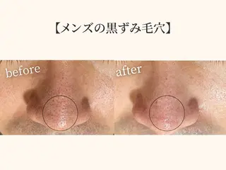 小顔矯正×毛穴サロン DRRAMSPA町田のエステ・リラクイメージ