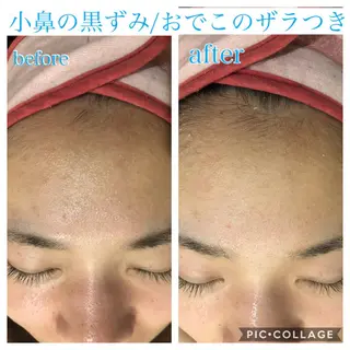 ロング カラー パーマ ヘアアレンジ キッズ ネイル マツエク・マツパ EnsorClair 代表 野口真央のエステ・リラクイメージ