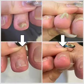 ネイル ネイルサロンailes所属・ネイルサロンエール 店長沼尻のネイルデザイン