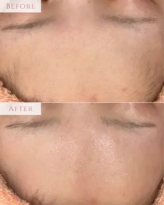 肌質改善専門サロン Bellmi/心斎橋のエステ・リラクイメージ