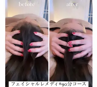 自律神経を整える フェイシャルエステのエステ・リラクイメージ