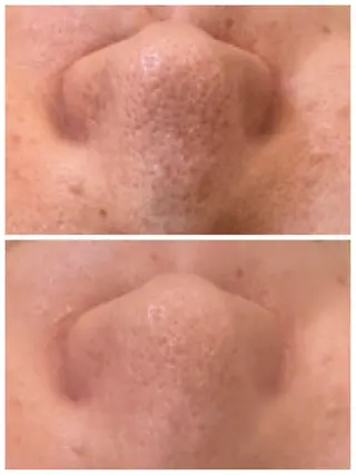 トータルビューティ サロンstageのエステ・リラクイメージ