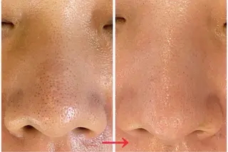 肌質改善サロン Manaririoのエステ・リラクイメージ