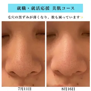 Bellesthe (ベルエステ)のエステ・リラクイメージ